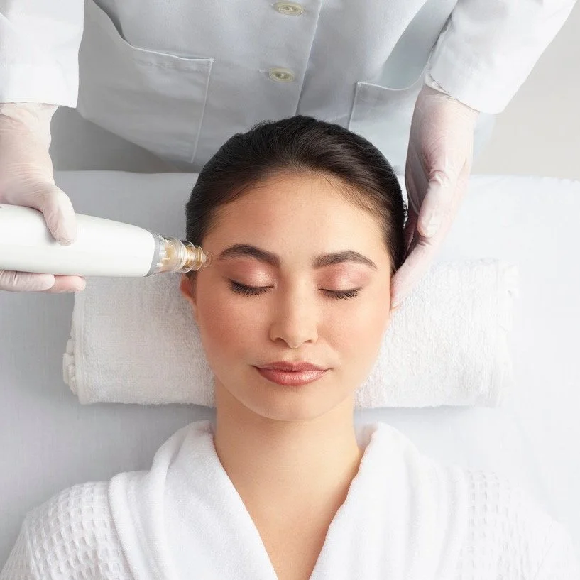 Potenza Radio Frequency RF Micro Needling - Edina | Minneapolis